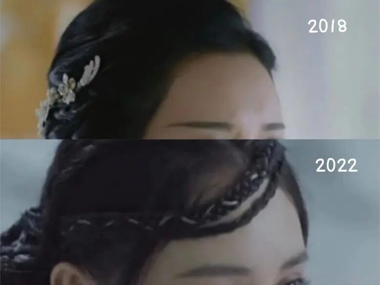 发际线后移不可逆？别慌，我有解决办法！（内含重磅福利）