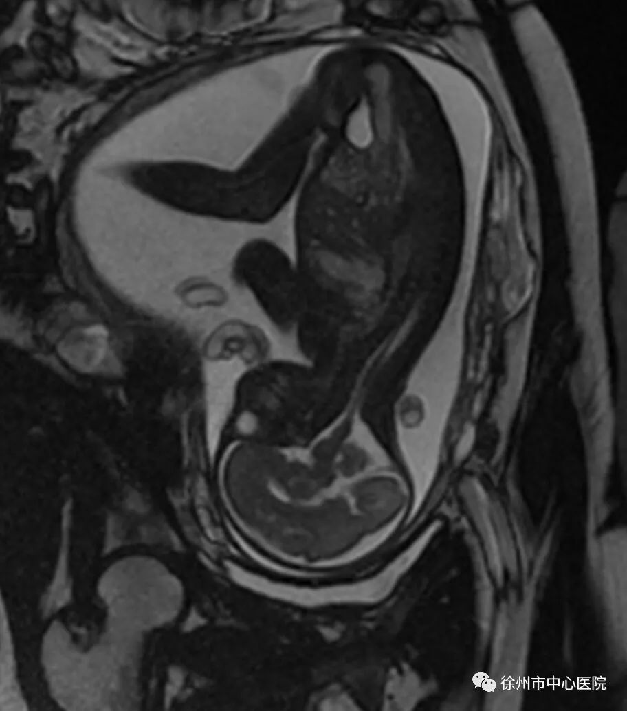 提醒胎儿也可以做磁共振了