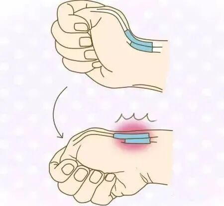 什么是牵引床“小针刀”是什么东西？ 听说它超厉害的！_https://www.jmylbn.com_新闻资讯_第3张