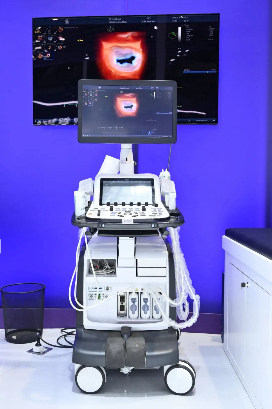 什么叫超声容积探头关爱无界，领创新声｜GE医疗超声CMEF盛况回放_https://www.jmylbn.com_新闻资讯_第12张