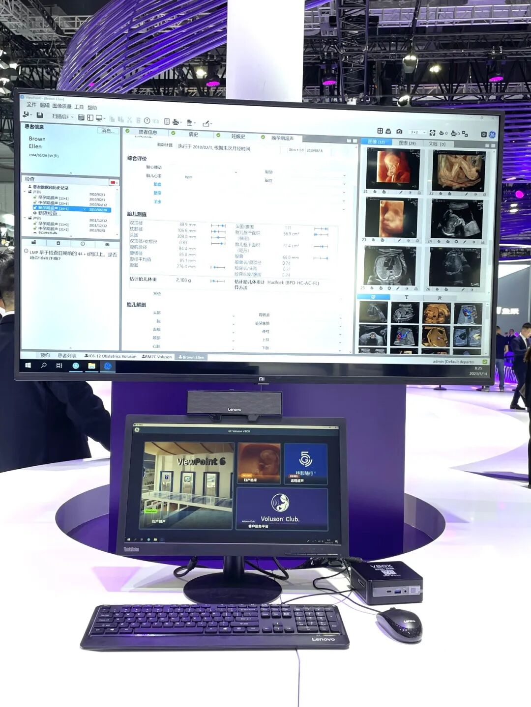 什么叫超声容积探头关爱无界，领创新声｜GE医疗超声CMEF盛况回放_https://www.jmylbn.com_新闻资讯_第30张