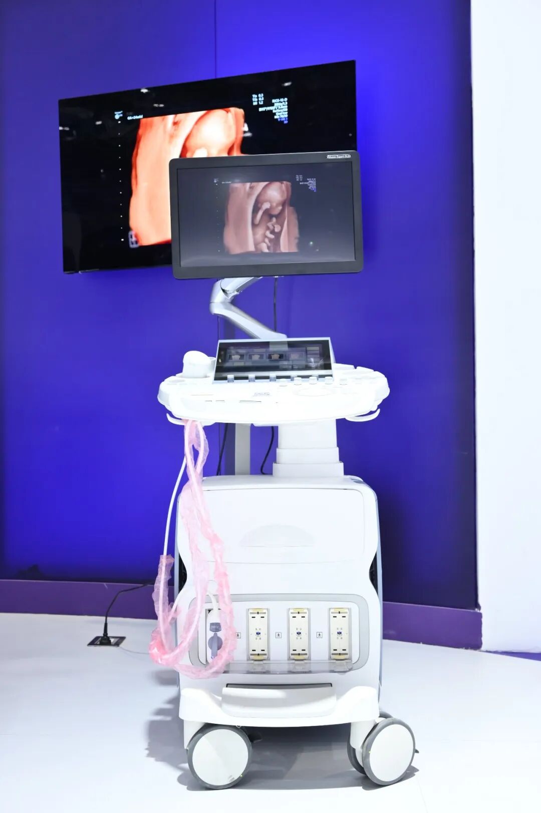 什么叫超声容积探头关爱无界，领创新声｜GE医疗超声CMEF盛况回放_https://www.jmylbn.com_新闻资讯_第15张