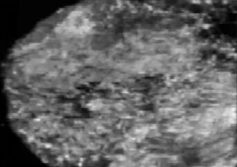 什么是超声容积探头自动乳腺容积超声技术专家共识（2022版）重点摘要_https://www.jmylbn.com_新闻资讯_第13张