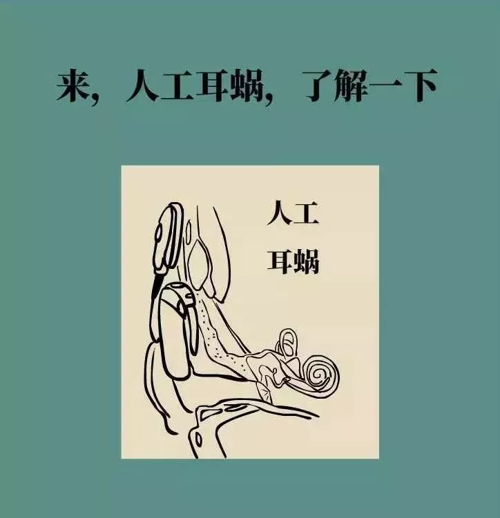 轻松科普|人工耳蜗—酷酷的“小耳朵” 轻松科普|人工耳蜗—酷酷的“小耳朵”