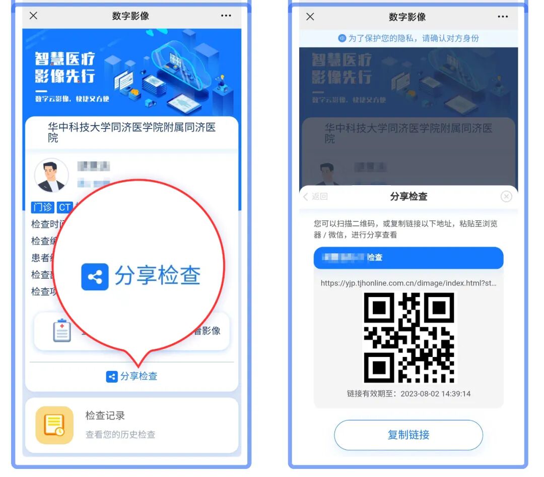 怎么自助取胶片医院【收藏】医学检查“云胶片”上线！无需取片，报告随时随地看！_https://www.jmylbn.com_新闻资讯_第9张
