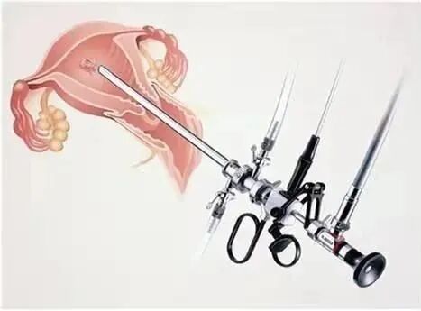 宫腔是什么地方久备不孕？可能是你的努力用错了地方，宫腔镜快速找到不孕原因！_https://www.jmylbn.com_新闻资讯_第5张