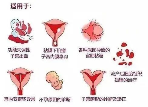 宫腔是什么地方久备不孕？可能是你的努力用错了地方，宫腔镜快速找到不孕原因！_https://www.jmylbn.com_新闻资讯_第6张