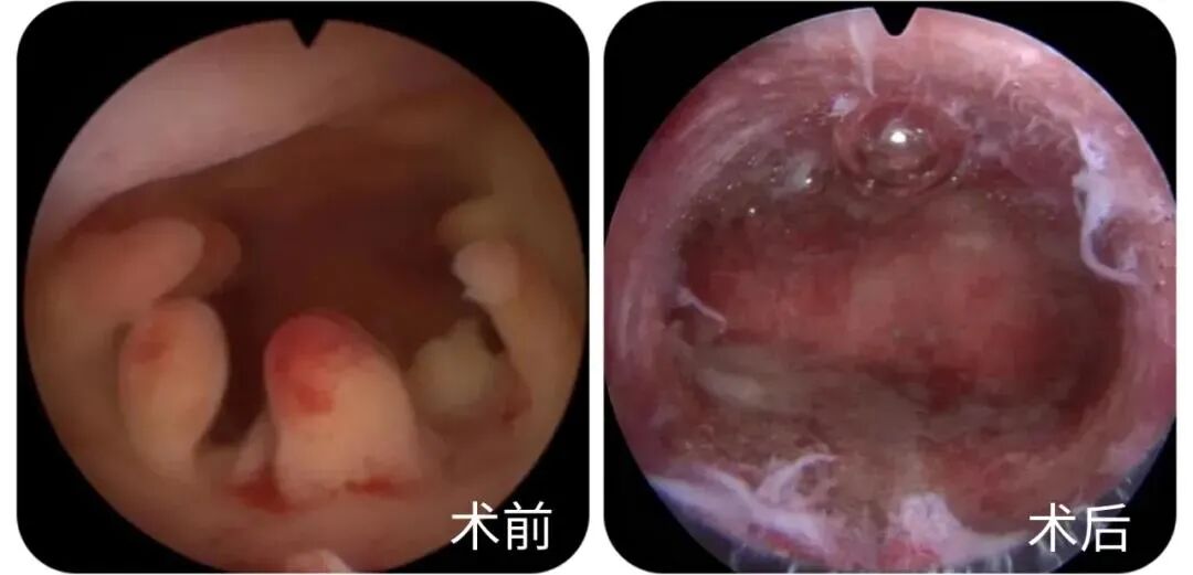 宫腔是什么地方久备不孕？可能是你的努力用错了地方，宫腔镜快速找到不孕原因！_https://www.jmylbn.com_新闻资讯_第4张