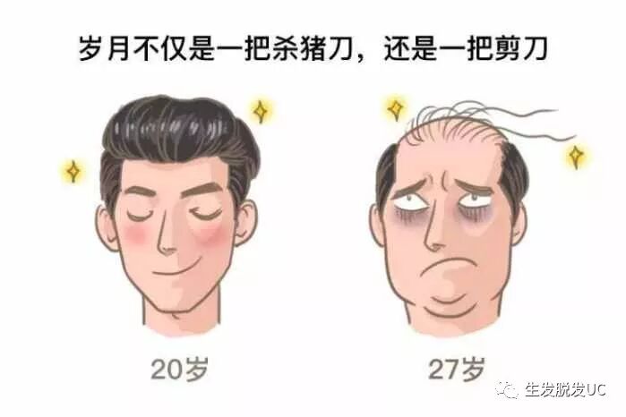 如何有效防止脱发严重,如何止脱生发？