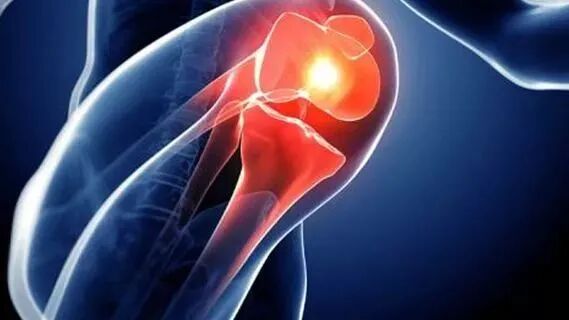 滑膜炎可以自愈吗，一文给你讲透滑膜炎的治疗与预防指南