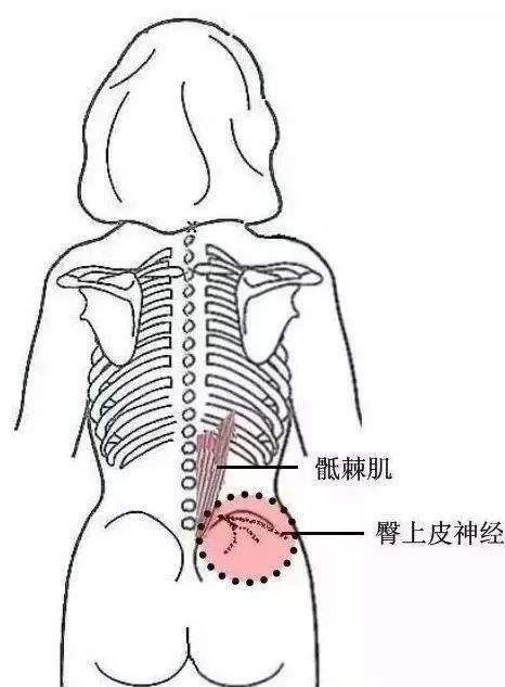 臀 4个方位 腿 5个方位 的疼痛意义 名医养生微信公众号文章