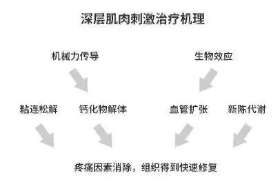 康复振动仪怎么使用缓解疼痛的新武器——电动肌肉振动仪 (DMS)_https://www.jmylbn.com_新闻资讯_第4张