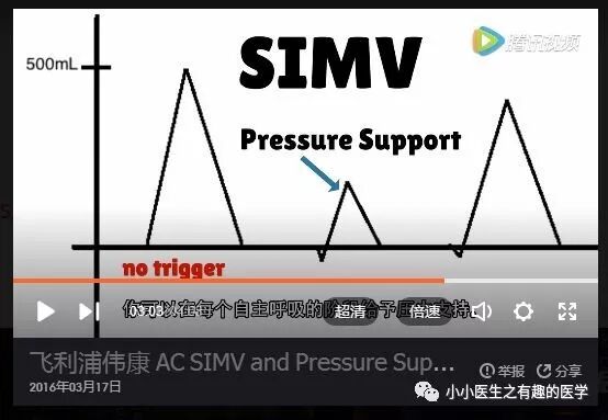 呼吸机ac是什么意思呼吸机：SIMV与AC模式的区别，不讲区别的都是耍流氓_https://www.jmylbn.com_新闻资讯_第13张