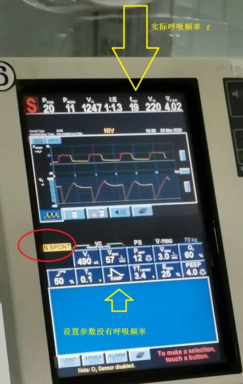 呼吸机怎么看呼吸重症：从呼吸机波形看自主呼吸_https://www.jmylbn.com_新闻资讯_第1张