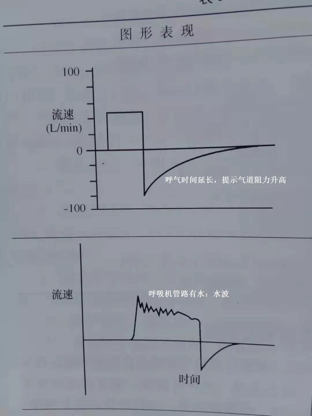 呼吸机怎么读卡呼吸机视频1：常见呼吸机模式+异常波形解读_https://www.jmylbn.com_新闻资讯_第11张
