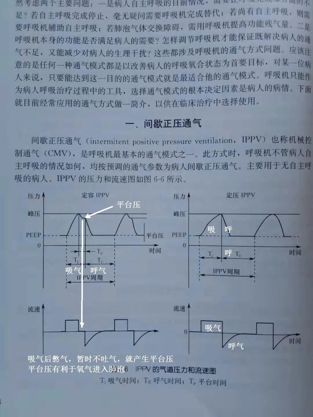 呼吸机怎么读卡呼吸机视频1：常见呼吸机模式+异常波形解读_https://www.jmylbn.com_新闻资讯_第10张