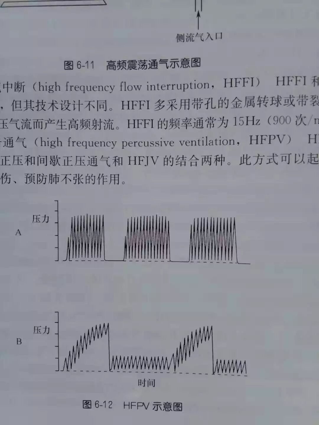 呼吸机怎么读卡呼吸机视频1：常见呼吸机模式+异常波形解读_https://www.jmylbn.com_新闻资讯_第13张