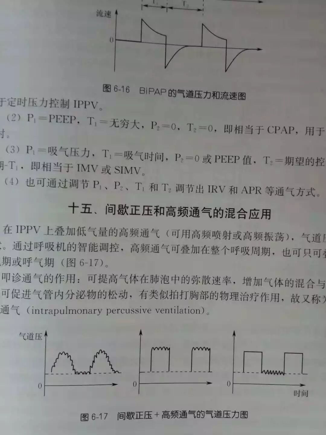 呼吸机怎么读卡呼吸机视频1：常见呼吸机模式+异常波形解读_https://www.jmylbn.com_新闻资讯_第12张