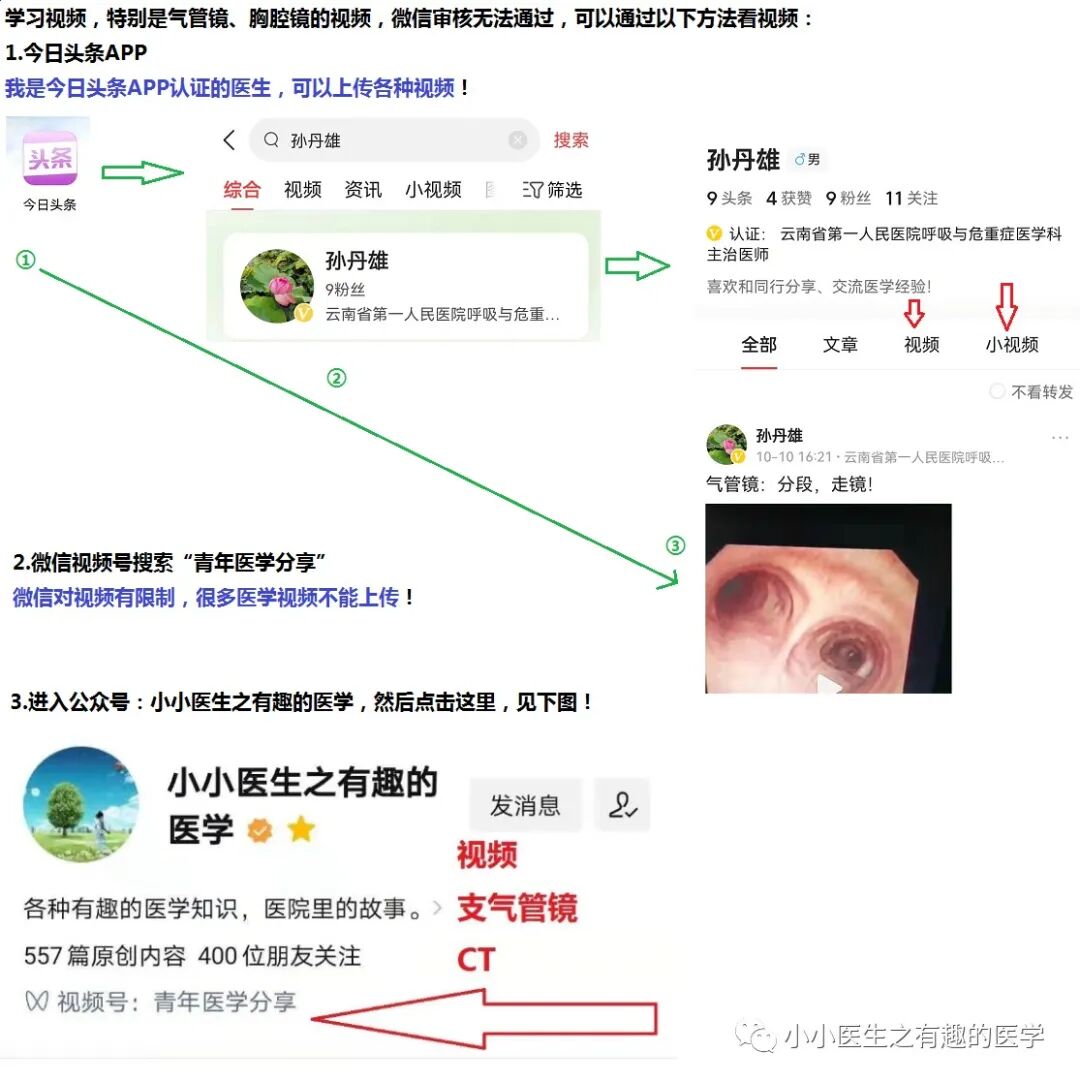 气腹管怎么接只因给氧方式不妥，气管镜术中病人突发腹胀、休克、呼吸衰竭_https://www.jmylbn.com_新闻资讯_第14张