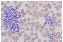 血常规用什么仪器检查干货：血常规检验必须关注的N个复检要点_https://www.jmylbn.com_新闻资讯_第7张