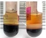 血常规用什么仪器检查干货：血常规检验必须关注的N个复检要点_https://www.jmylbn.com_新闻资讯_第5张