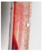 血常规用什么仪器检查干货：血常规检验必须关注的N个复检要点_https://www.jmylbn.com_新闻资讯_第4张