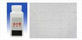 血常规用什么仪器检查干货：血常规检验必须关注的N个复检要点_https://www.jmylbn.com_新闻资讯_第11张