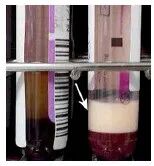 血常规用什么仪器检查干货：血常规检验必须关注的N个复检要点_https://www.jmylbn.com_新闻资讯_第3张