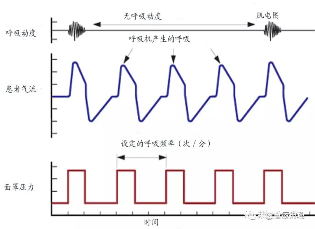 呼吸机湿化罐怎么加水【执业规范】无创呼吸机使用教程（收藏）_https://www.jmylbn.com_新闻资讯_第13张