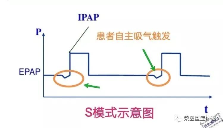 呼吸机湿化罐怎么加水【执业规范】无创呼吸机使用教程（收藏）_https://www.jmylbn.com_新闻资讯_第9张
