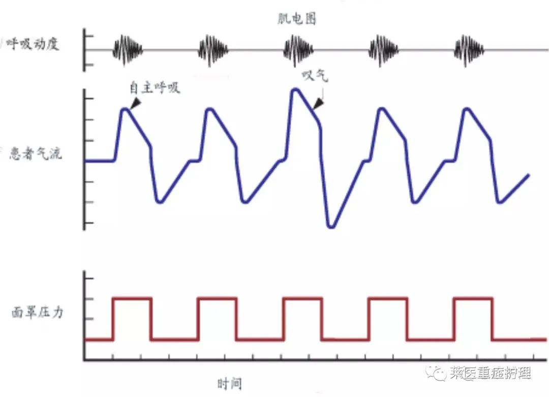 呼吸机湿化罐怎么加水【执业规范】无创呼吸机使用教程（收藏）_https://www.jmylbn.com_新闻资讯_第8张