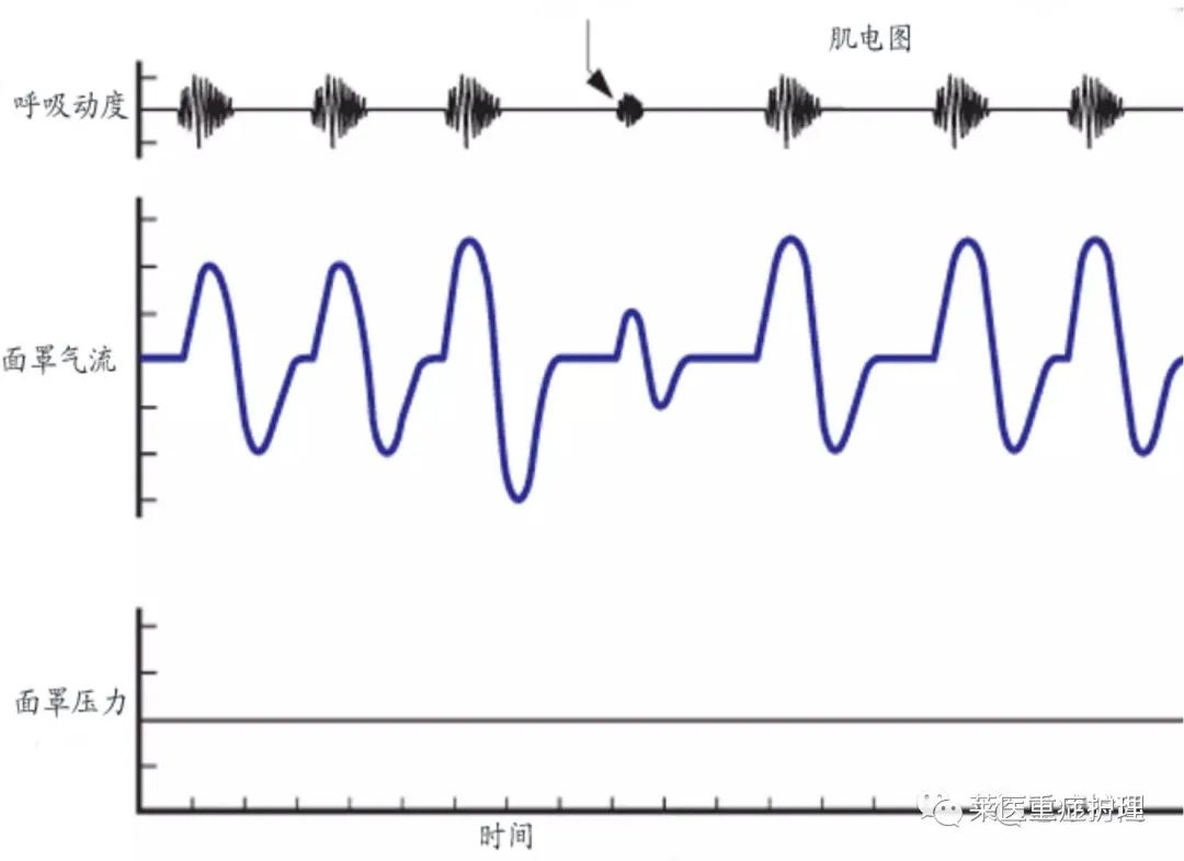 呼吸机湿化罐怎么加水【执业规范】无创呼吸机使用教程（收藏）_https://www.jmylbn.com_新闻资讯_第15张