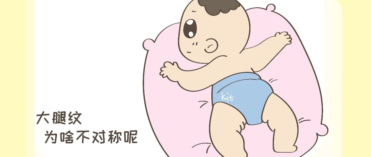 宝宝的大腿纹为啥不对称？这是什么情况？带你一起了解下