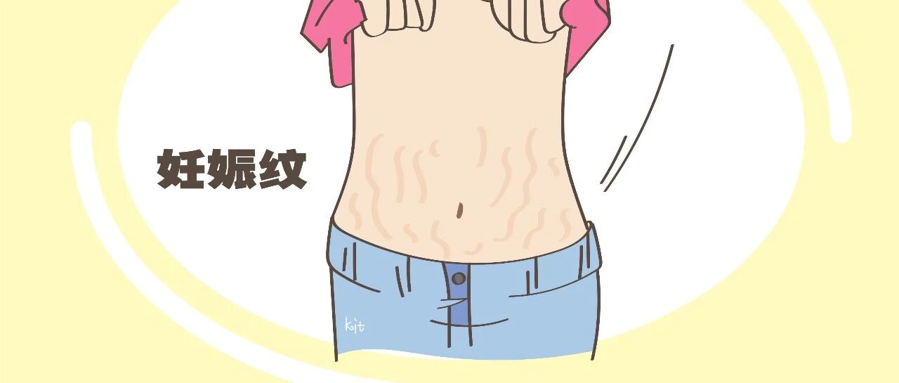 要想肚皮上干干净净，没有一条妊娠纹，这些细节不能错过！