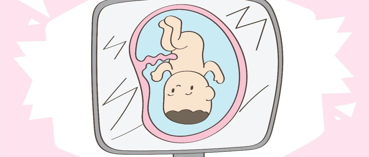 别做“手欠”孕妈，这几个小动作，是脐带缠脖的元凶