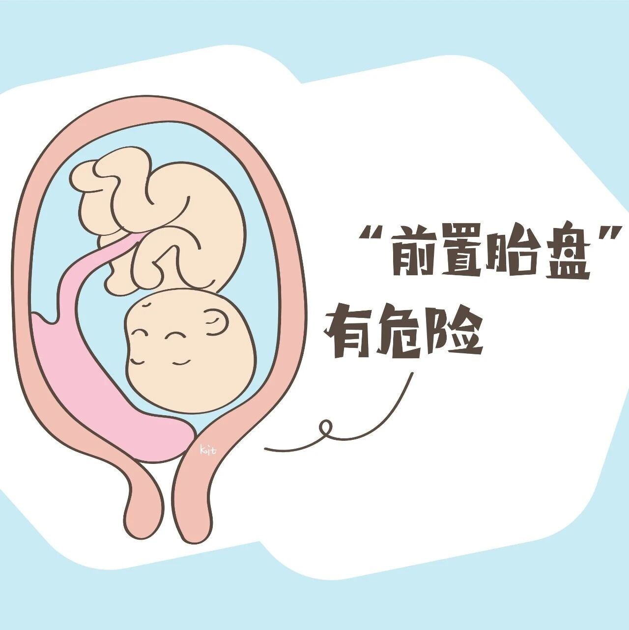 检出“前置胎盘”有危险，孕妈要警惕3种行为，可有效预防问题发生！