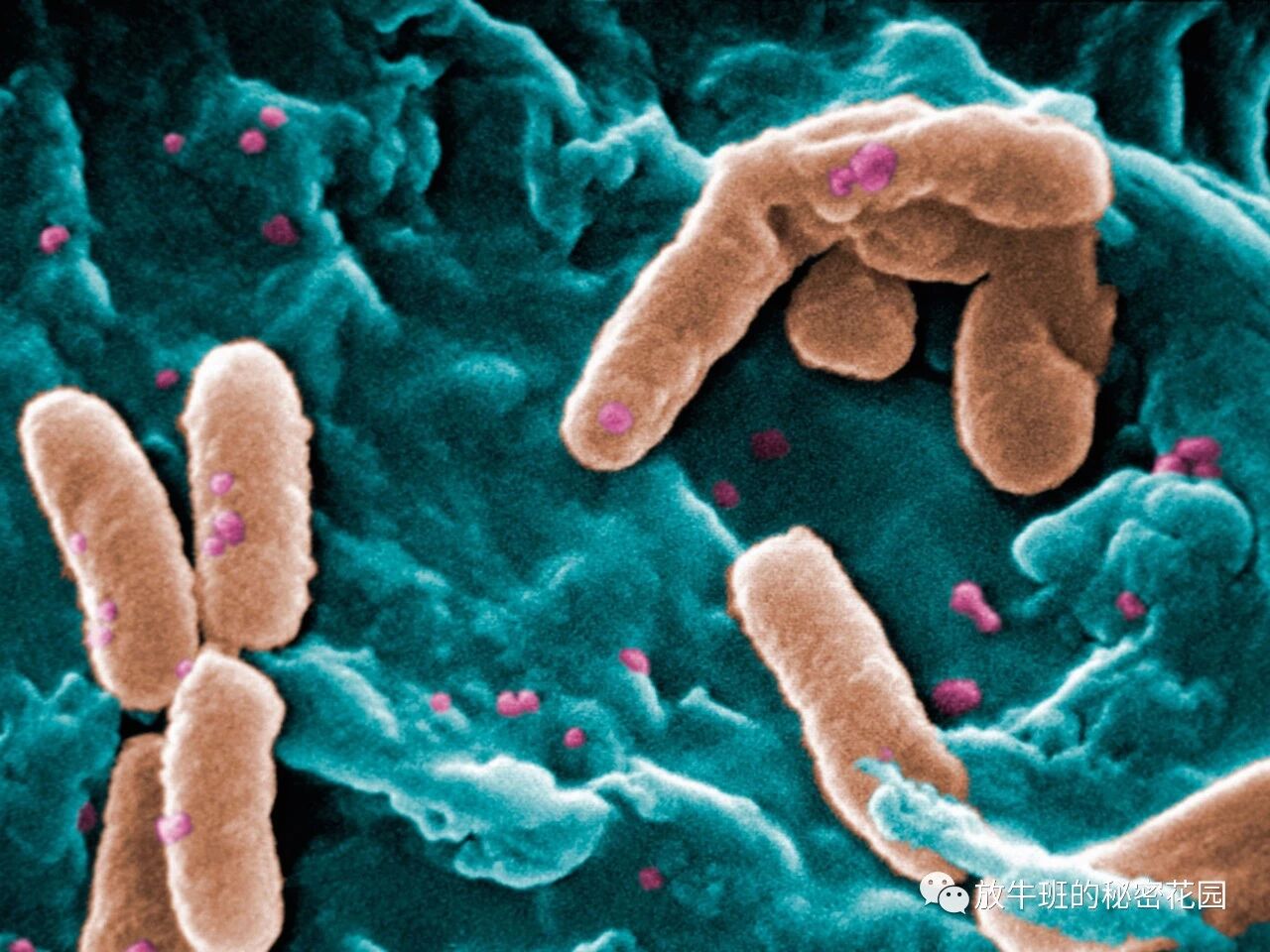 《《连线》：科学家首次通过基因改造病毒拯救了一位重病少女》