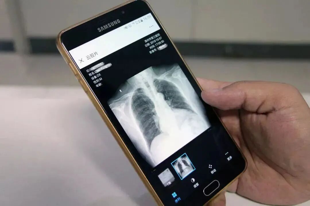 医用ct胶片怎么收纳“云胶片”太方便，查看结果一部手机就够了！CT、磁共振影像报告可存手机带走_https://www.jmylbn.com_新闻资讯_第3张