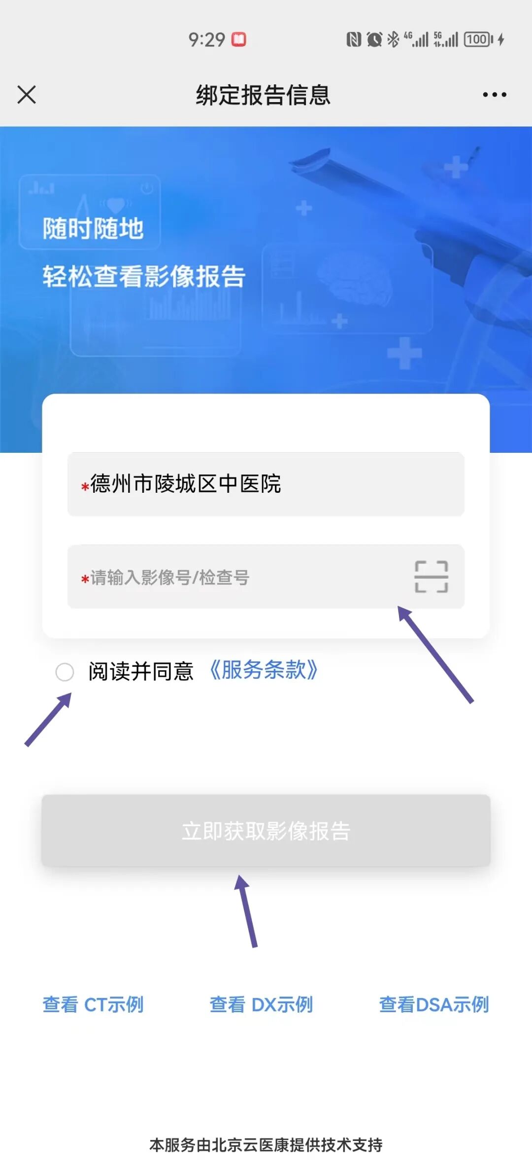 医用ct胶片怎么收纳“云胶片”太方便，查看结果一部手机就够了！CT、磁共振影像报告可存手机带走_https://www.jmylbn.com_新闻资讯_第9张