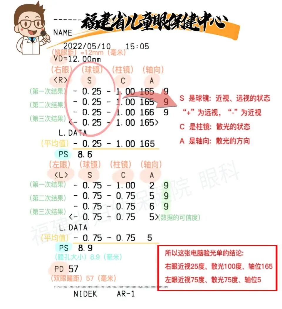 儿童保健电脑怎么用【特色学科】一图教您看懂孩子的电脑验光单_https://www.jmylbn.com_新闻资讯_第4张