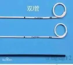 猪尾巴导管怎么拔出【科普】泌尿外科的猪尾巴_https://www.jmylbn.com_新闻资讯_第6张