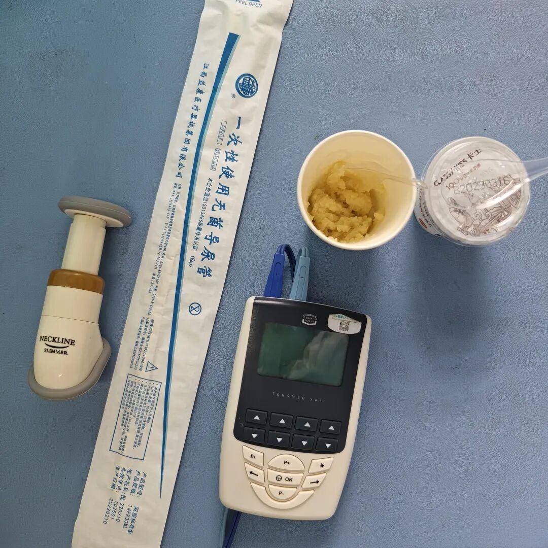 医讯怎么用【医讯】“如鲠在喉”到“畅通无阻” ——吞咽障碍之球囊扩张术的应用_https://www.jmylbn.com_新闻资讯_第3张