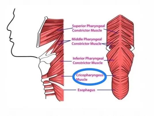 医讯怎么用【医讯】“如鲠在喉”到“畅通无阻” ——吞咽障碍之球囊扩张术的应用_https://www.jmylbn.com_新闻资讯_第2张
