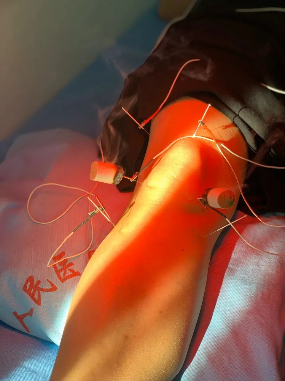 康复理疗设备怎么生产【我为群众办实事】患者福音！我院康复理疗科引进新技术新设备！_https://www.jmylbn.com_新闻资讯_第15张