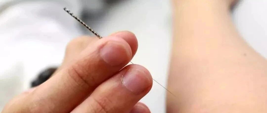 肩周炎可针刺一个穴位，速愈