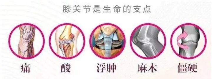 滑膜炎积液消不掉？这个方法真厉害，治好了妈妈10年的滑膜炎