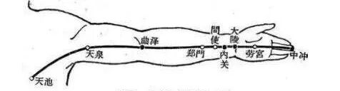 艾灸心包经，远离心肌梗塞！ - 第5张