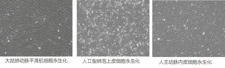 “高效穩(wěn)定，精準(zhǔn)轉(zhuǎn)染——尚恩生物慢病毒轉(zhuǎn)染服務(wù)全新登場！”