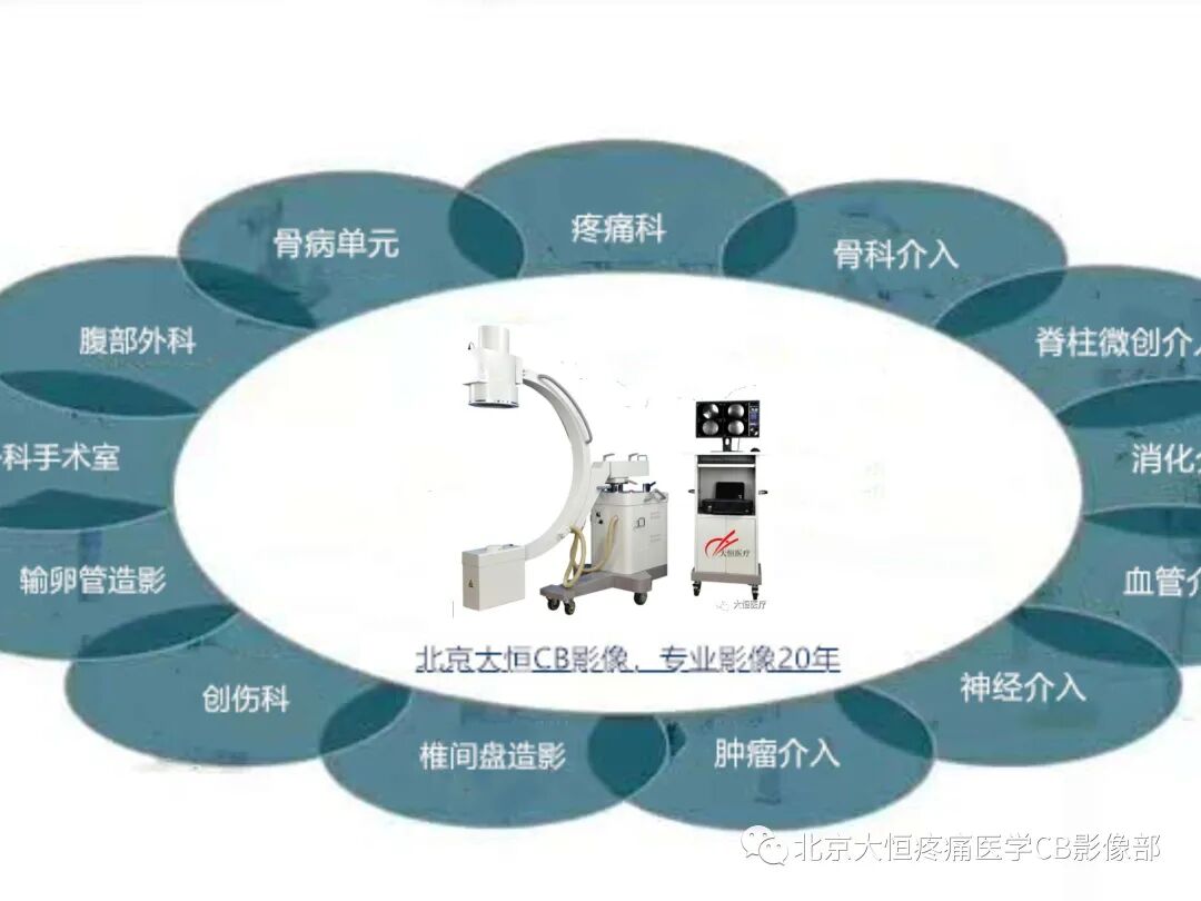 c臂机怎么关机C型臂X光机定义：_https://www.jmylbn.com_新闻资讯_第6张