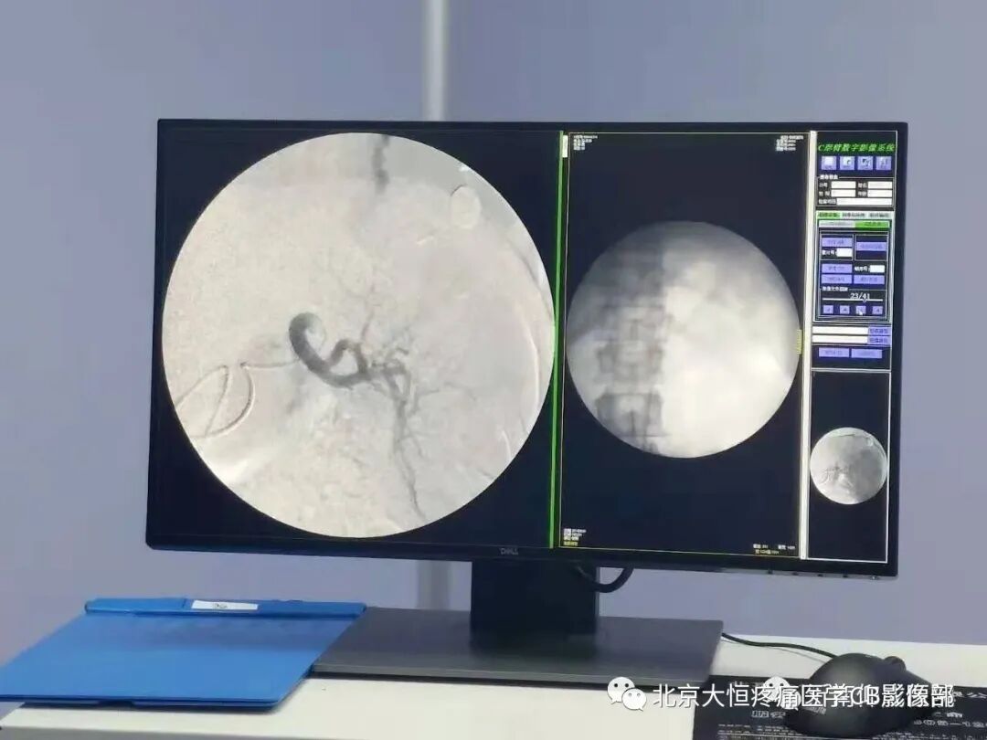 c臂机怎么关机C型臂X光机定义：_https://www.jmylbn.com_新闻资讯_第4张